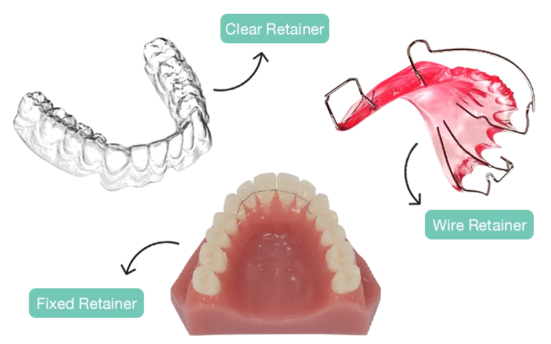 retainer-1