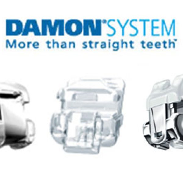 Damon System